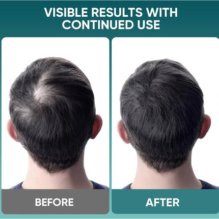 Farndu Repair Hair Growth Shampoo – Moisturizing & Strengthening